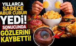 Yıllarca sadece abur cubur yedi, sonucunda gözlerini kaybetti!