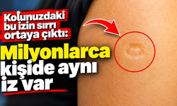 Kolunuzdaki bu izin sırrı ortaya çıktı: Milyonlarca kişide aynı iz var