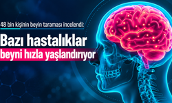 48 bin kişinin beyin taraması incelendi: Bazı hastalıklar beyni hızla yaşlandırıyor