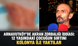 Arnavutköy'de akran zorbalığı iddiası: 12 yaşındaki çocuğun sırtını kolonya ile yaktılar