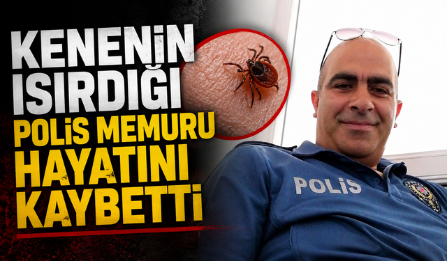 Kenenin ısırdığı polis memuru hayatını kaybetti