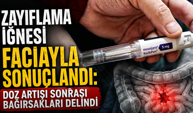Zayıflama iğnesi faciayla sonuçlandı: Doz artışı sonrası bağırsakları delindi