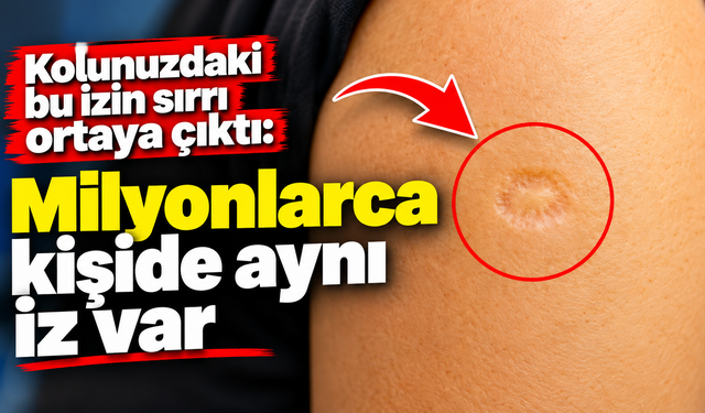 Kolunuzdaki bu izin sırrı ortaya çıktı: Milyonlarca kişide aynı iz var