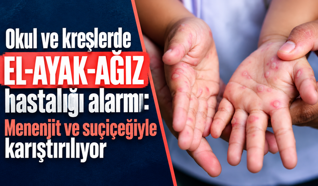 Okul ve kreşlerde el-ayak-ağız hastalığı alarmı: Menenjit ve suçiçeğiyle karıştırılıyor